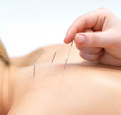 AcupunctureSample1